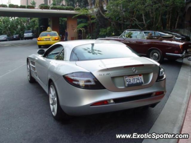 Mercedes SLR spotted in Beverly hills Hotel, California